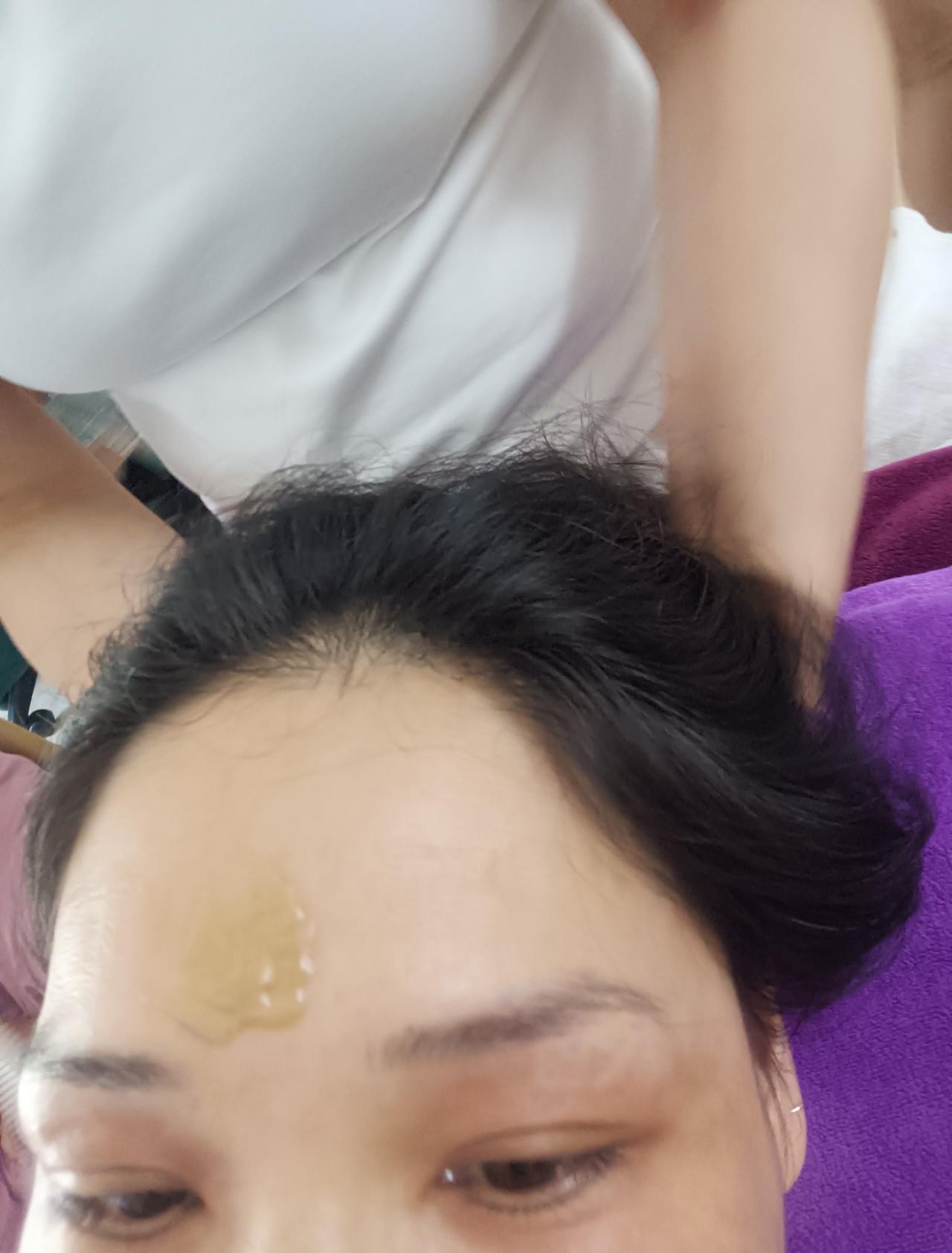 这几天眼睛干疼
找了个眼部护理的地方试试
眼睛都按肿了
（额头上的是药膏） 
好