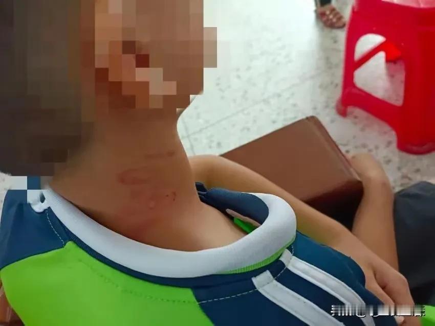 这位校长的行为实在令人震惊！学生仅仅因为忘记戴红领巾，校长竟然上前撸着学生的脖子