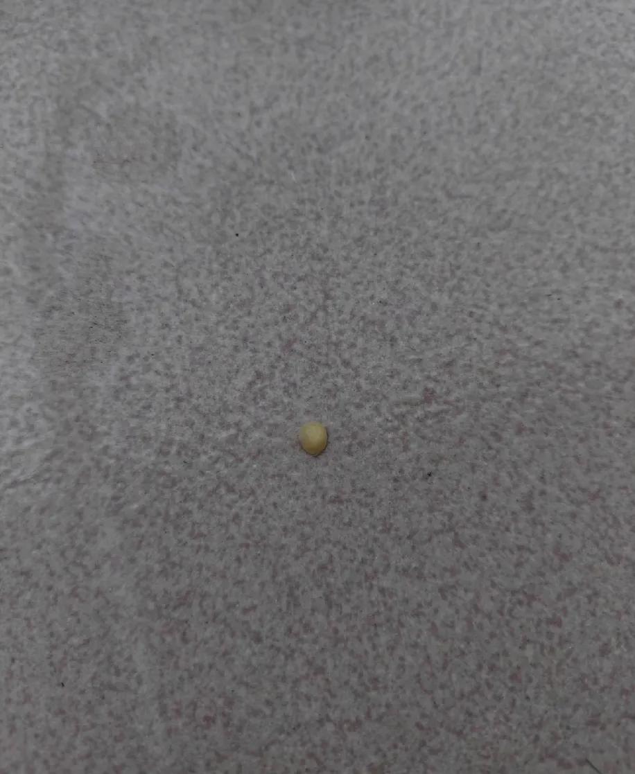 一碗兰州拉面差点把我整出“生理阴影”——就这颗指甲盖大的花椒壳，愣是在我舌头根上