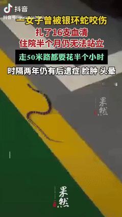 “命真大！”一女子和丈夫去云南普洱旅游时，在酒店不幸被银环蛇咬伤，本以为扎了16