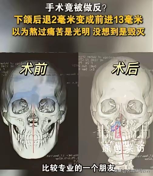 万万没想到！湖北武汉，24岁女子满心欢喜地躺上手术台，本想通过一场微调手术告别那