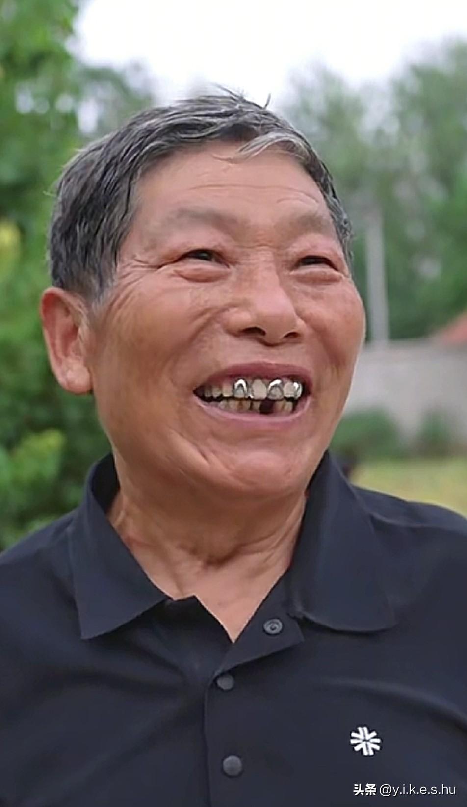 树兰牙齿所剩无几，细心的网友发现树兰假牙又多了几颗