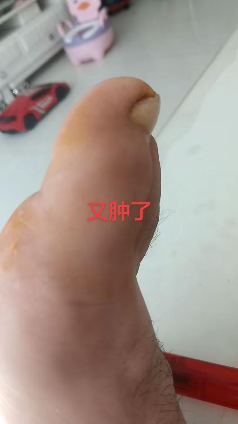 好痛。难搞痒比疼更让人崩溃