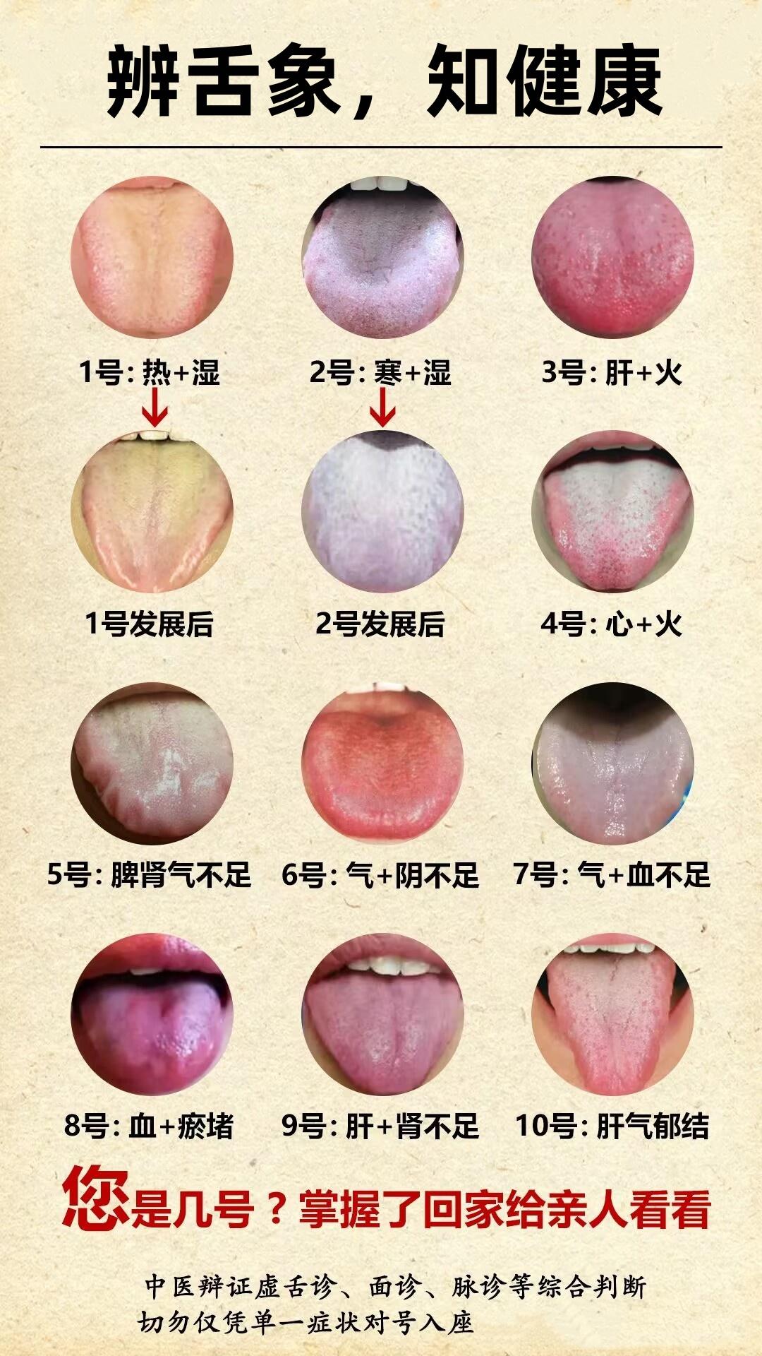 身体好不好，看舌象就知道！一人一舌一辨证，你发我就看！

有的人自认为身体很好，