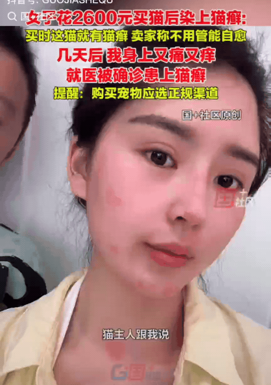 后悔也晚了！浙江嘉兴，女子花了2600元买了一只猫。万万没想到，几天后，自己脸上