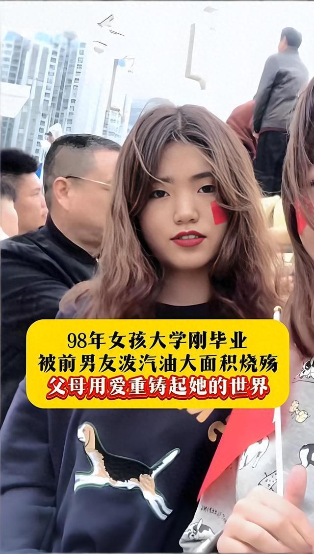 她被前男友泼汽油烧伤毁容！施暴者：得不到就毁了你。
“得不到就毁了你”，这是多么