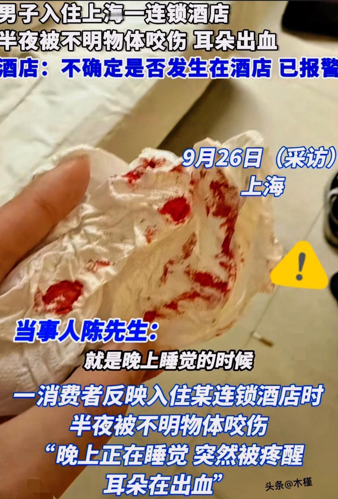 上海一男子住酒店疑似被鼠咬伤，酒店回应引争议

恶近日，上海一位男子在酒店住宿时