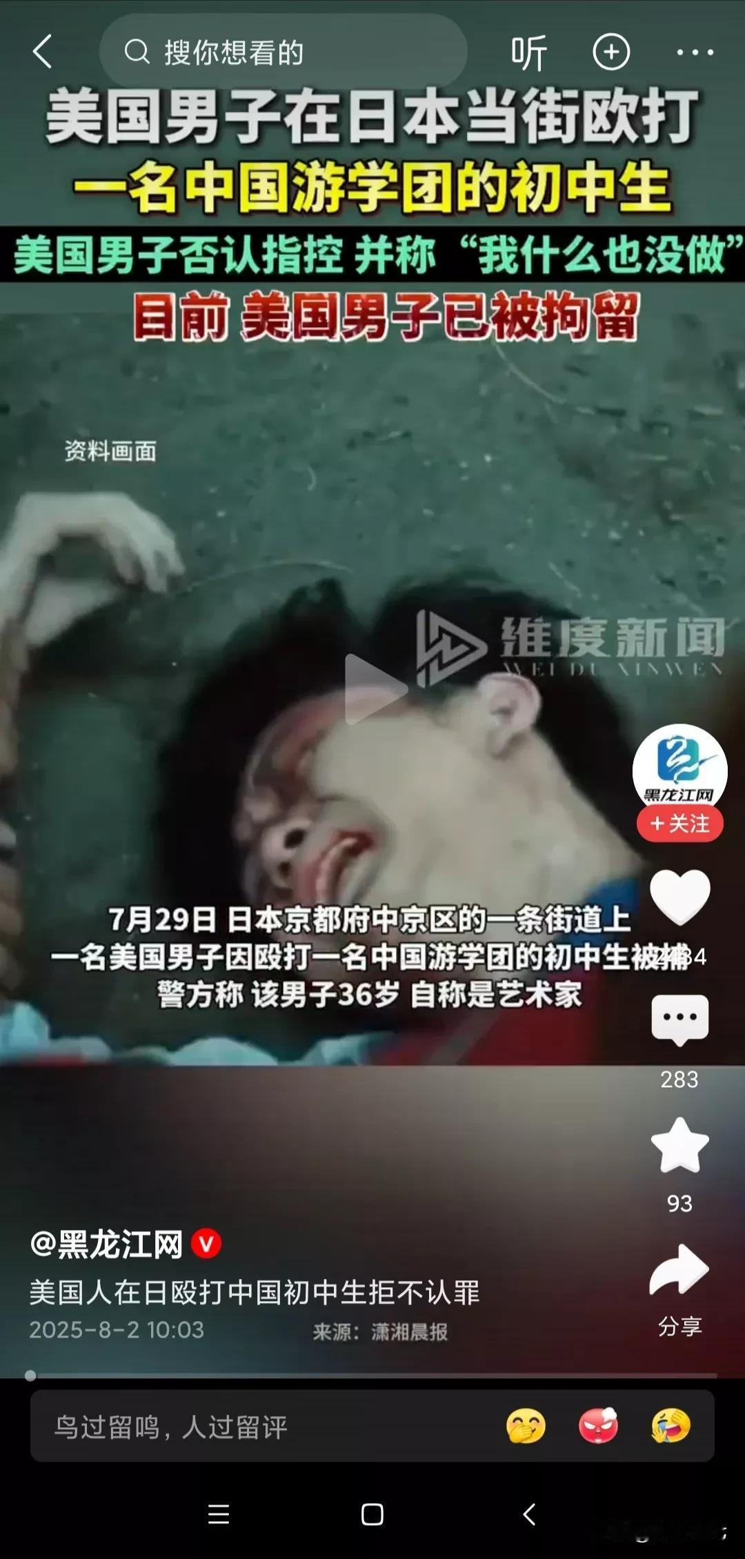 这到底是怎么了？
为什么受欺负的总是我们
7月31日，中国游客在日本被四个人爆头