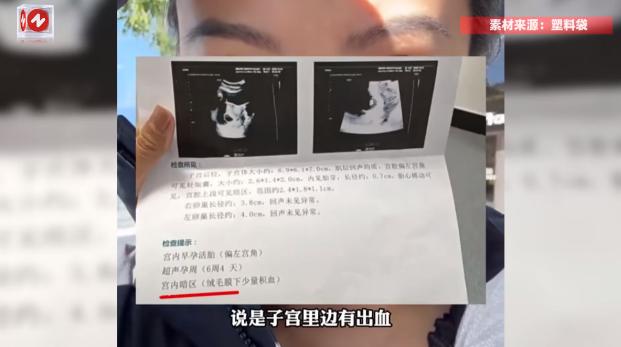 北京，一女子因为天气变冷，便在床上铺了电热毯取暖，谁知没过几天竟然感觉腹痛，去了