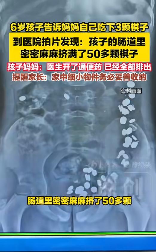 万万没有想到，5月21日报道，河北廊坊，一名6岁男孩玩着玩着，突然告知母亲自己吞