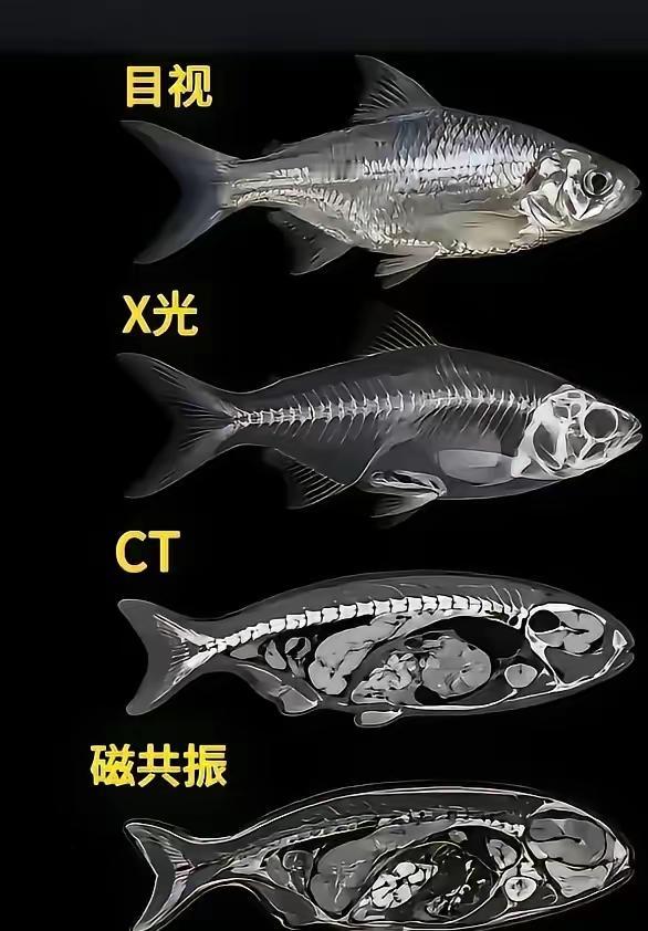 目视、X光、CT、磁共振对比！看懂影像的强大力量