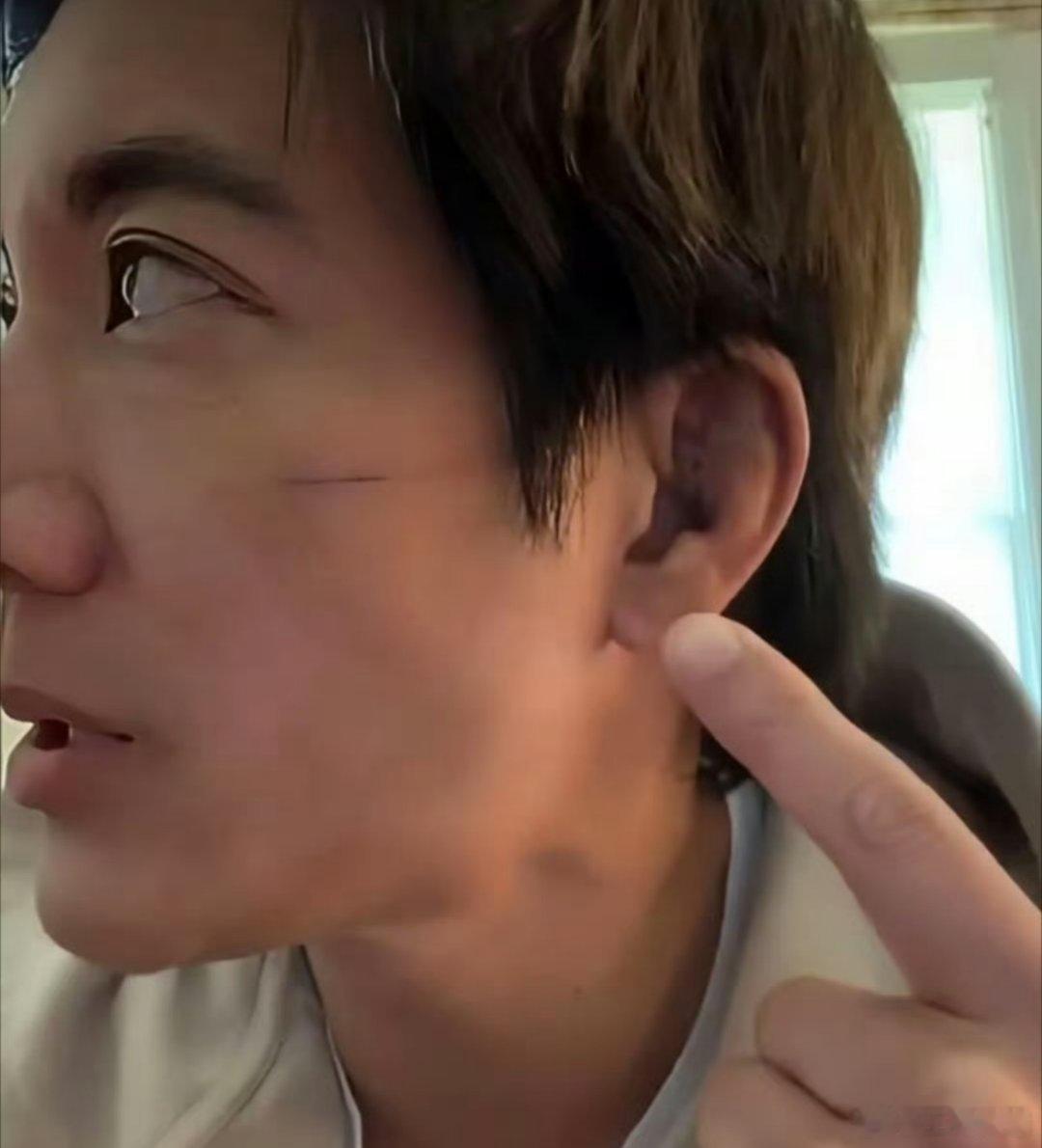 王力宏不忍心团队成员遭受非议二哥真棒啊，虽然受伤了但还维护自己的团队，不希望他们