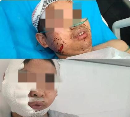 长沙海洋公园里的鲨鱼咬人了？
事发的湘江欢乐海洋公园位于长沙大王山旅游度假区湘江