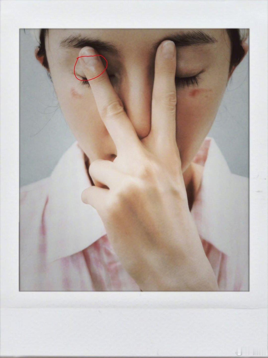 其实我很好奇，为什么有的人的月牙那么大，都快占了二分之一了，而有的人甚至都没有杨