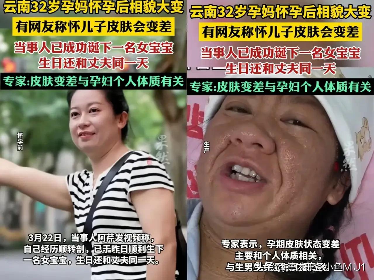 云南一位32岁宝妈怀孕，容貌大变样，脸长痘，毛孔粗大，皱纹加深，肤色暗沉，和怀孕