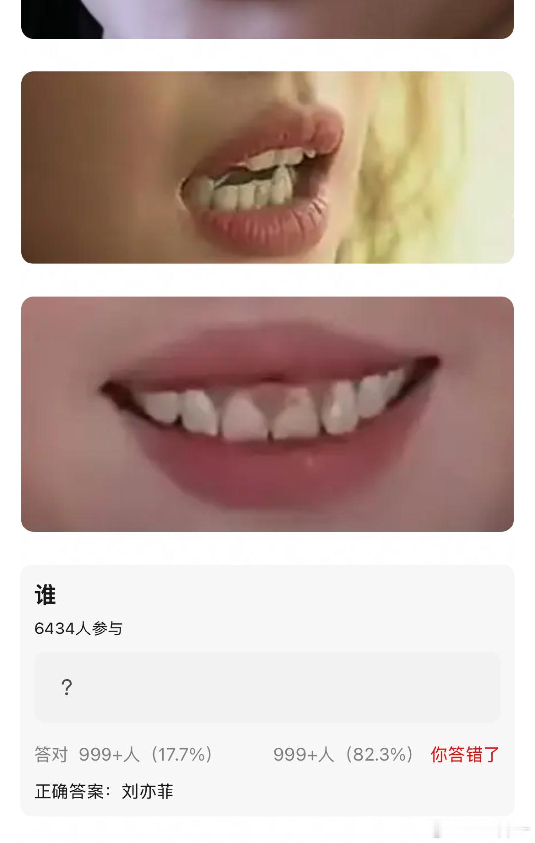刘亦菲 今日来欣赏天线姐姐的牙齿，谁不想要刘亦菲的牙齿呢 