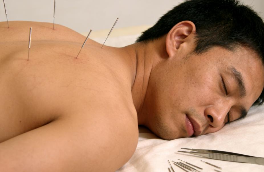 过度针灸会伤身！针灸的这些常见误区，你知道吗



针灸是咱们熟悉的传统养生方式