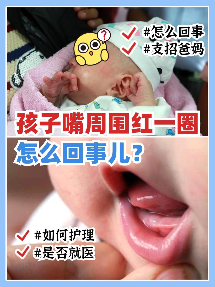 孩子嘴周围红一圈怎么回事？2步护理简单有效

👩‍🍼 刚升级妈妈，带娃真是难