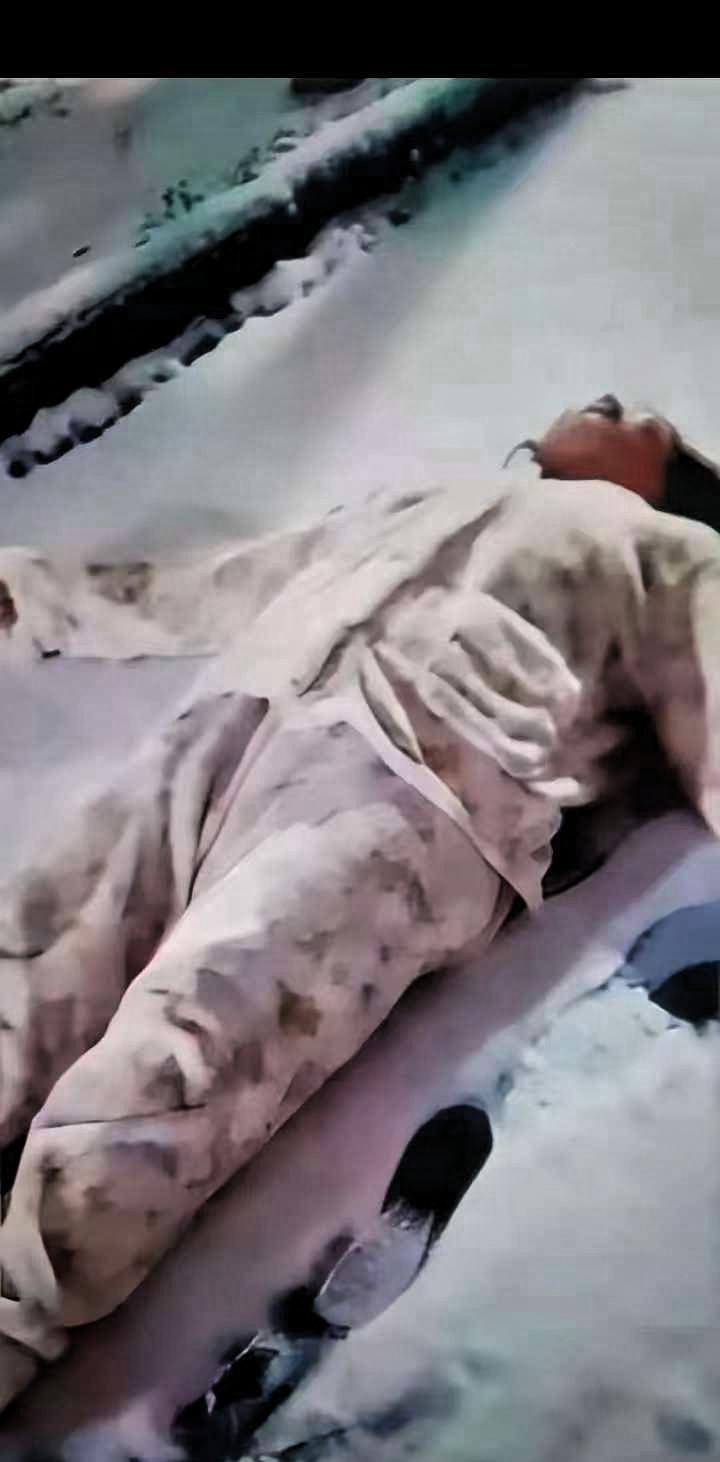 痛心！太快了，妻子下雪出去溜达玩，突然不小心后脑勺着地，当时摔的人不会吭声了，双