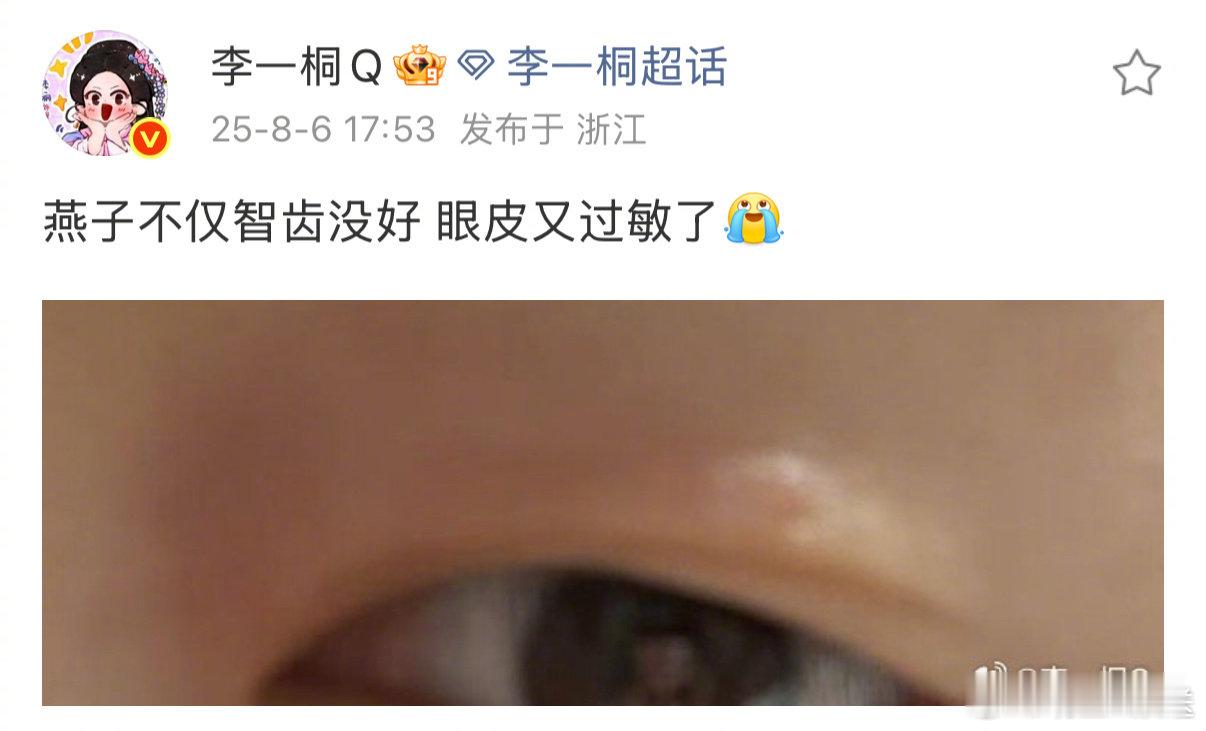 李一桐蜜蜂小狗预备役李一桐智齿没好眼皮又过敏了 近日，透露自己智齿没好眼皮又过敏