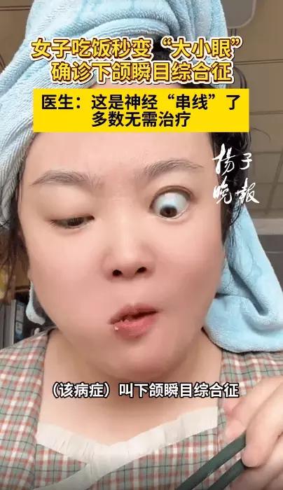 女子吃饭秒变“大小眼”，挺神奇的。黑龙江曹女士吃饭时一张嘴，上眼睑就上抬，眼睛变