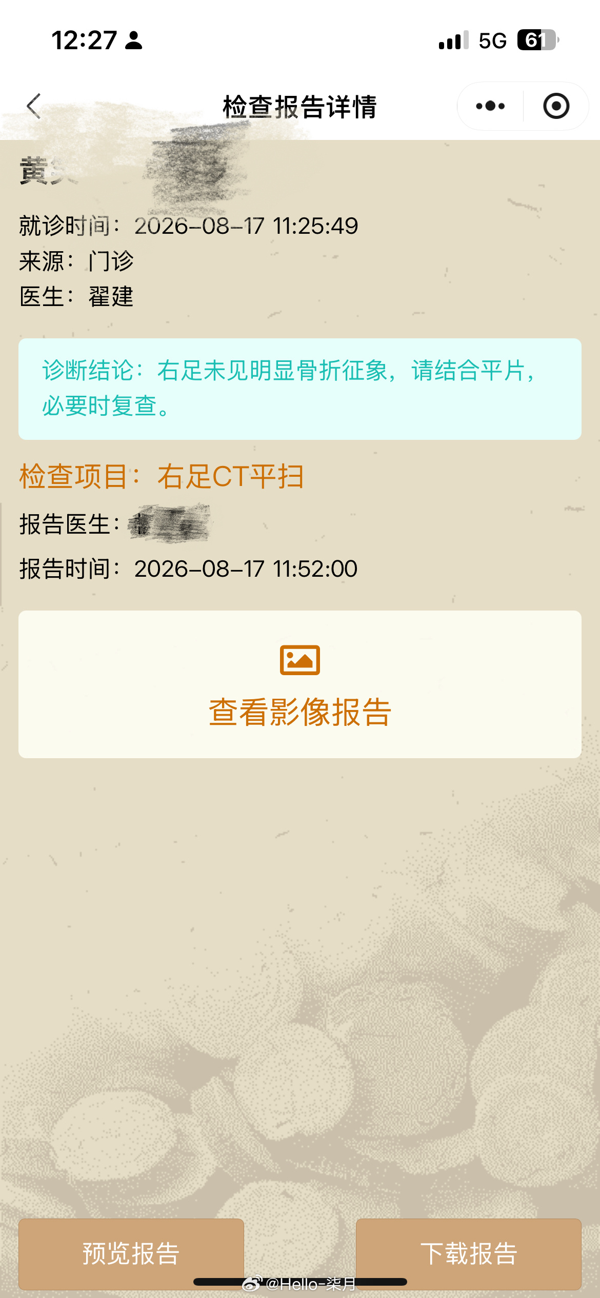 817，差点喜提同款脚背骨折！