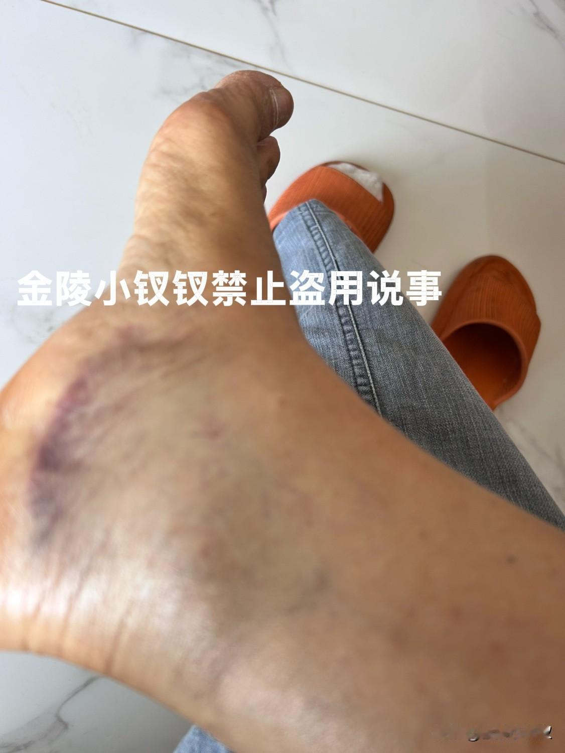 有点肉关键时刻能救命！

今天天气晴好，外面刮着大风，我坐在沙发上刷手机，一低头