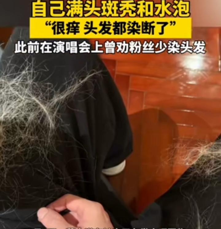 著名男歌手提醒粉丝：头发能不染就别染，虽然看上去时尚前卫，可脱发.断发.皮肤过敏