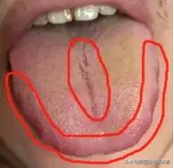 男人最怕黄腻苔！一补就上火？3步走帮你补回根基不内耗
 
大家好，我是陈大夫。