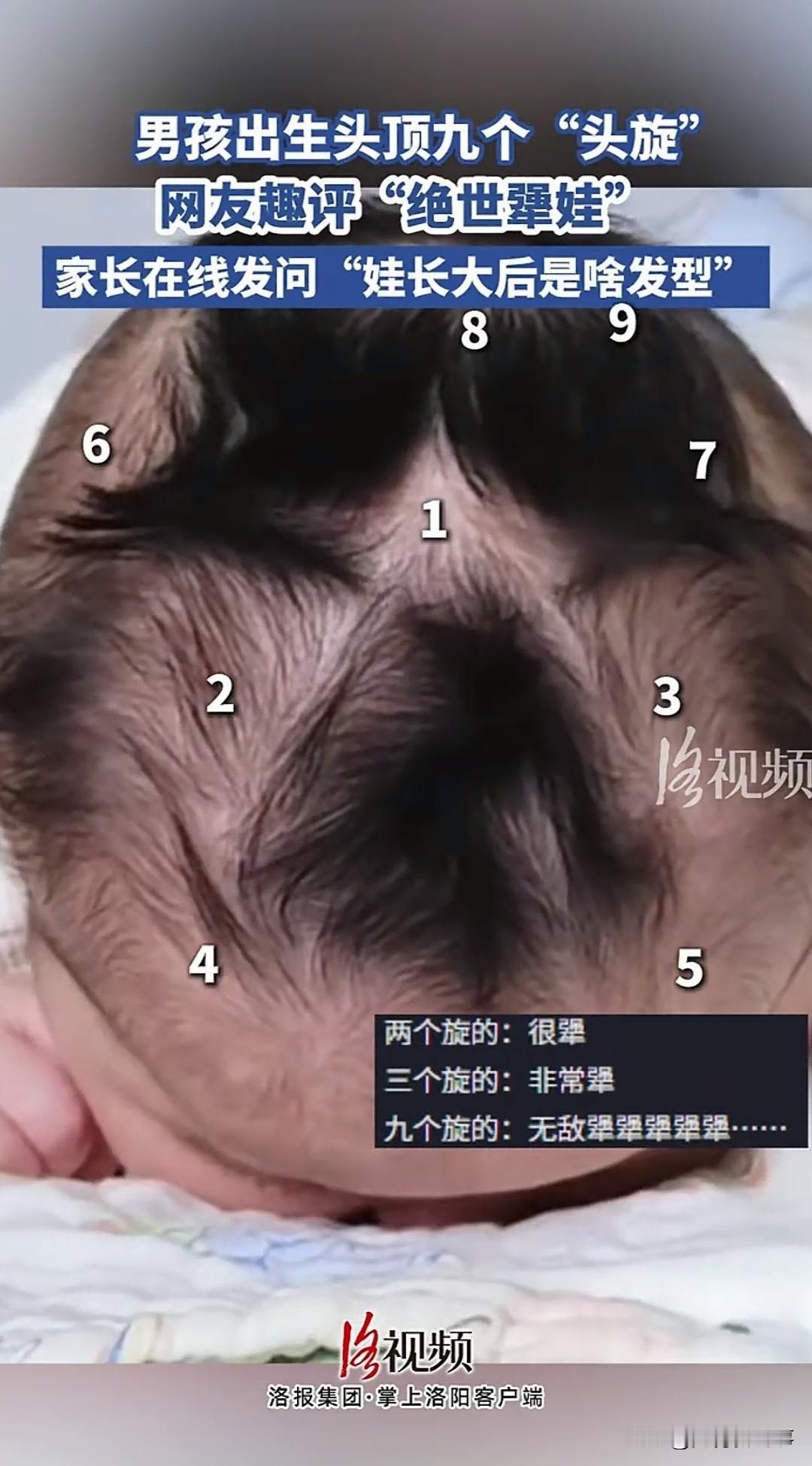 你见过最多几个头旋的人？我见过最多三个，直到看到浙江这个宝宝，直接刷新了我的认知