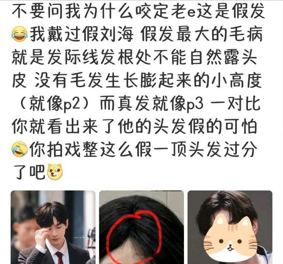专业假发博主说过他的头套好多次了，都不用这么复杂！他发旋从后脑勺突变到头顶就可以