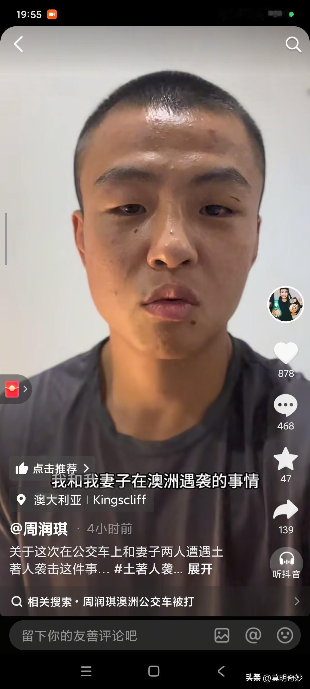 震惊！事发澳大利亚，中国职业拳王周润琪被澳洲当地人扎破脑袋，血流不止！

10月