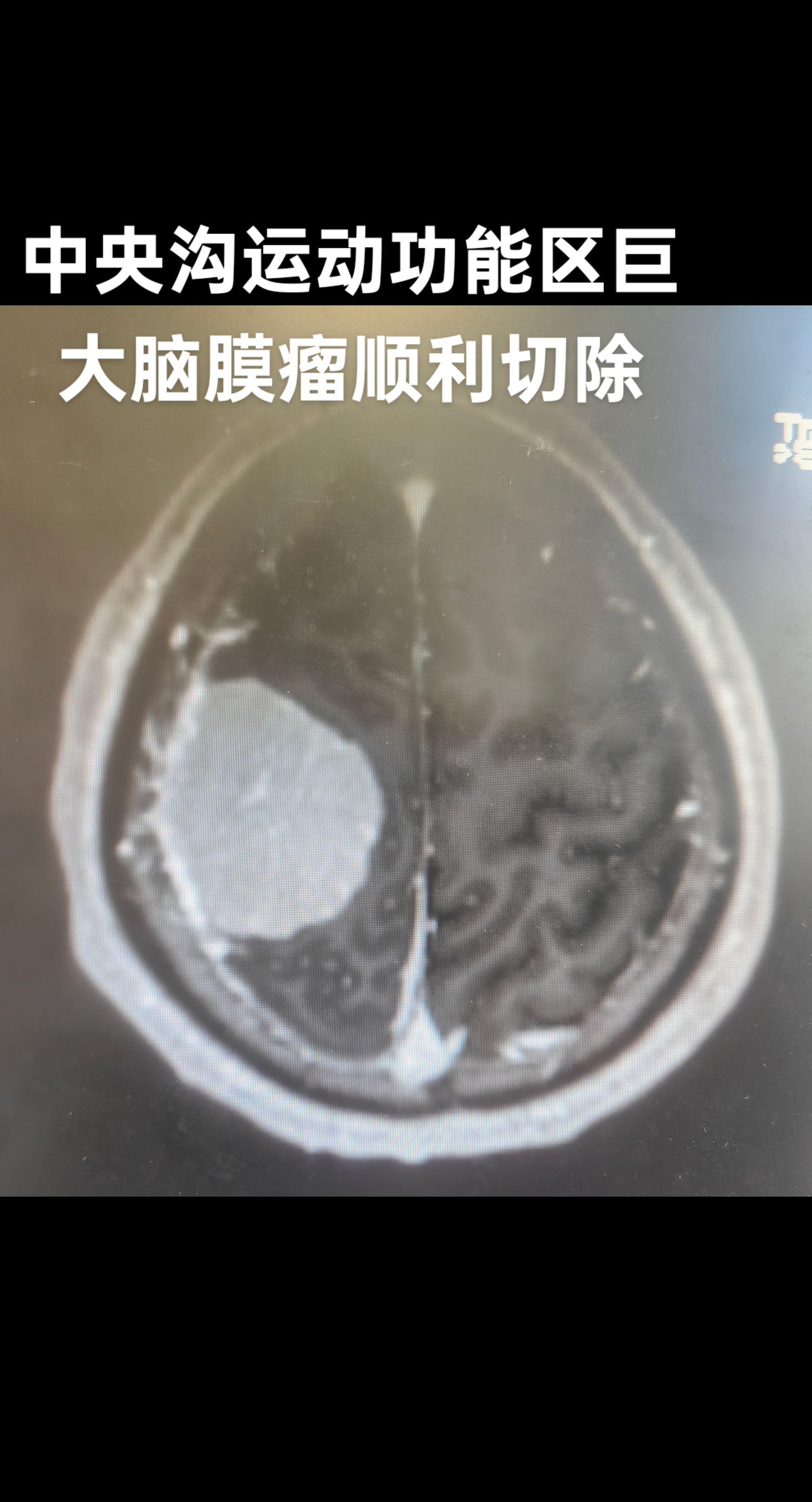 医学科普 关注健康