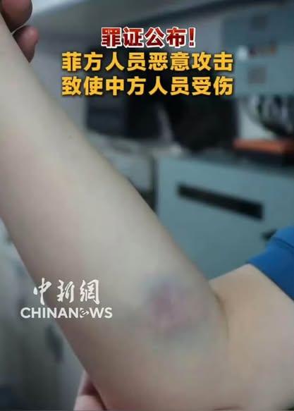 我方海警兄弟也有受伤，内伤。

咱们得常备长一点的铁棍，以防猴子再到我海域撒野，