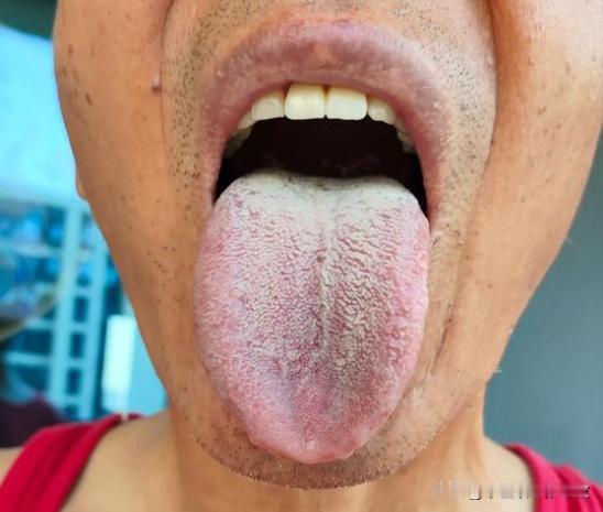 你说你一个大老爷们，咋能阳虚成这副样子呢[what][what][what]
主