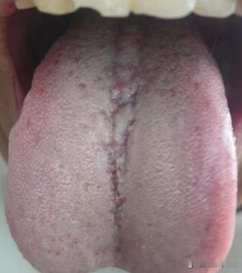 男人疲软敏感别乱补阳！精血充沛，宗筋自然强健






很多朋友一旦遇见海绵体