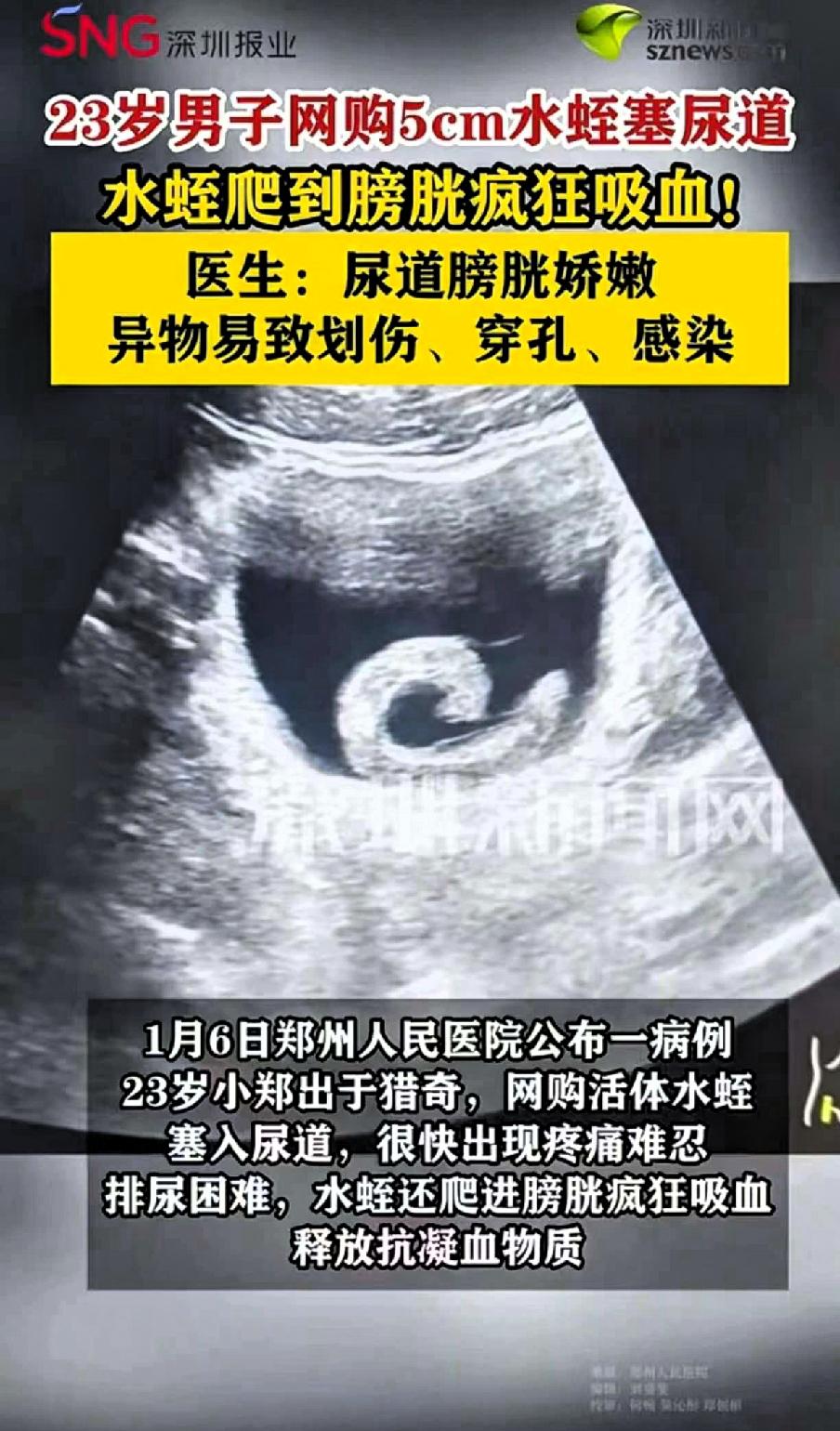 再也不敢了”
近日，河南郑州一名23岁的男子闲着太无聊了，在网上认识了一些网友，