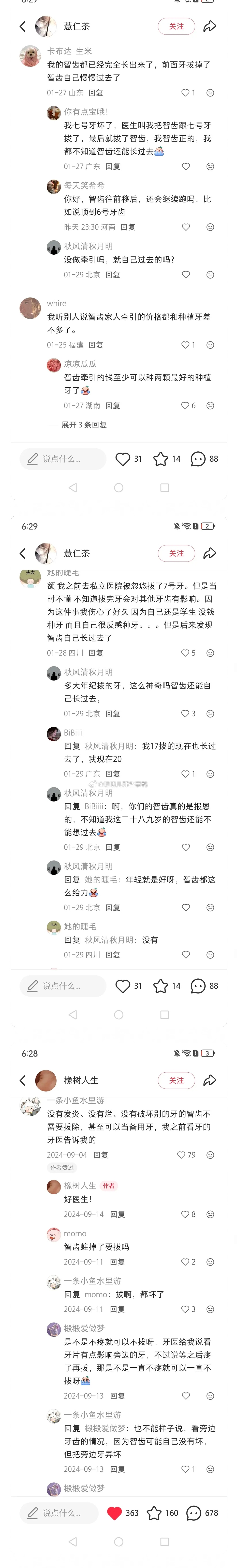 一篇关于补牙、智齿、拔牙和洗牙的帖子，码住（长图～