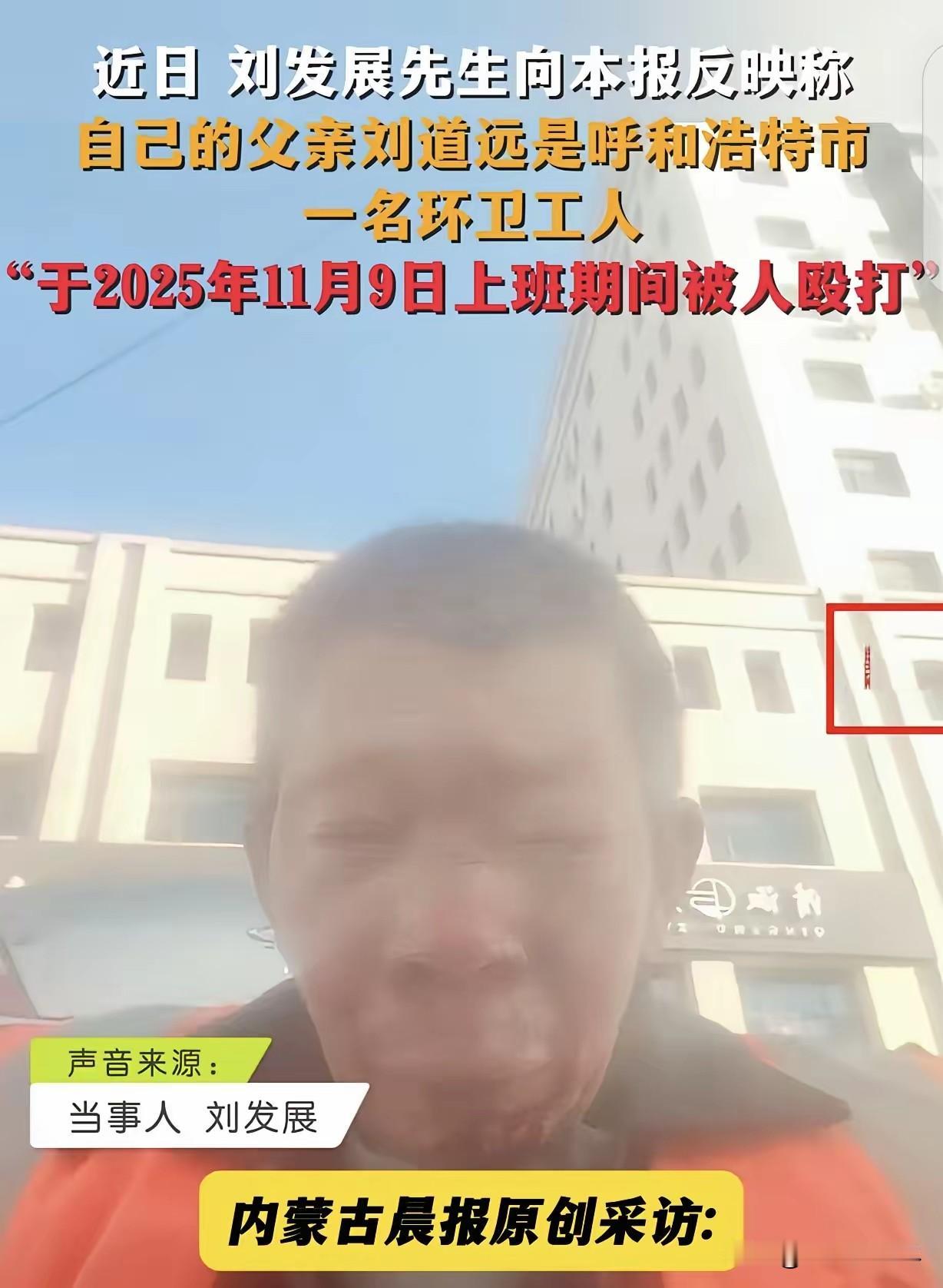 内蒙古，一环卫工大爷干活时，被一男子莫名其妙打得视网膜被脱落，晶体都取出来了，肋