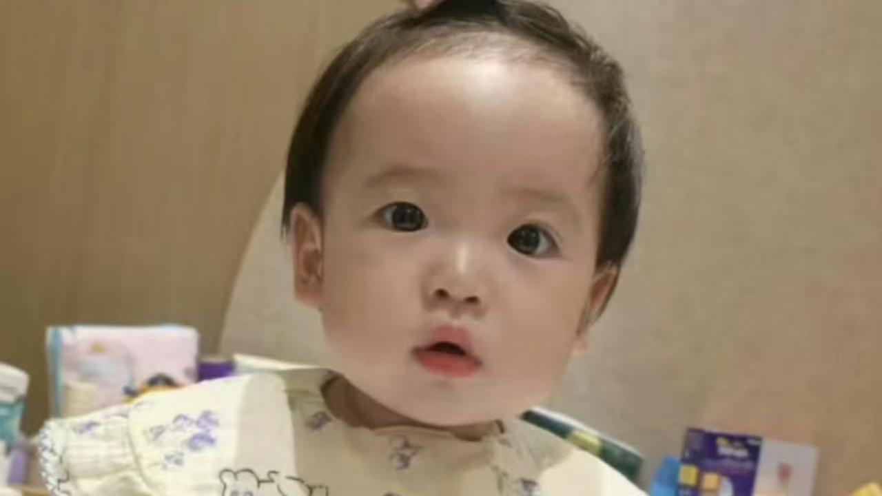 手术成功，6.5厘米的横行手术创口未缝合
12月20日，小洛熙的妈妈在社交平台公