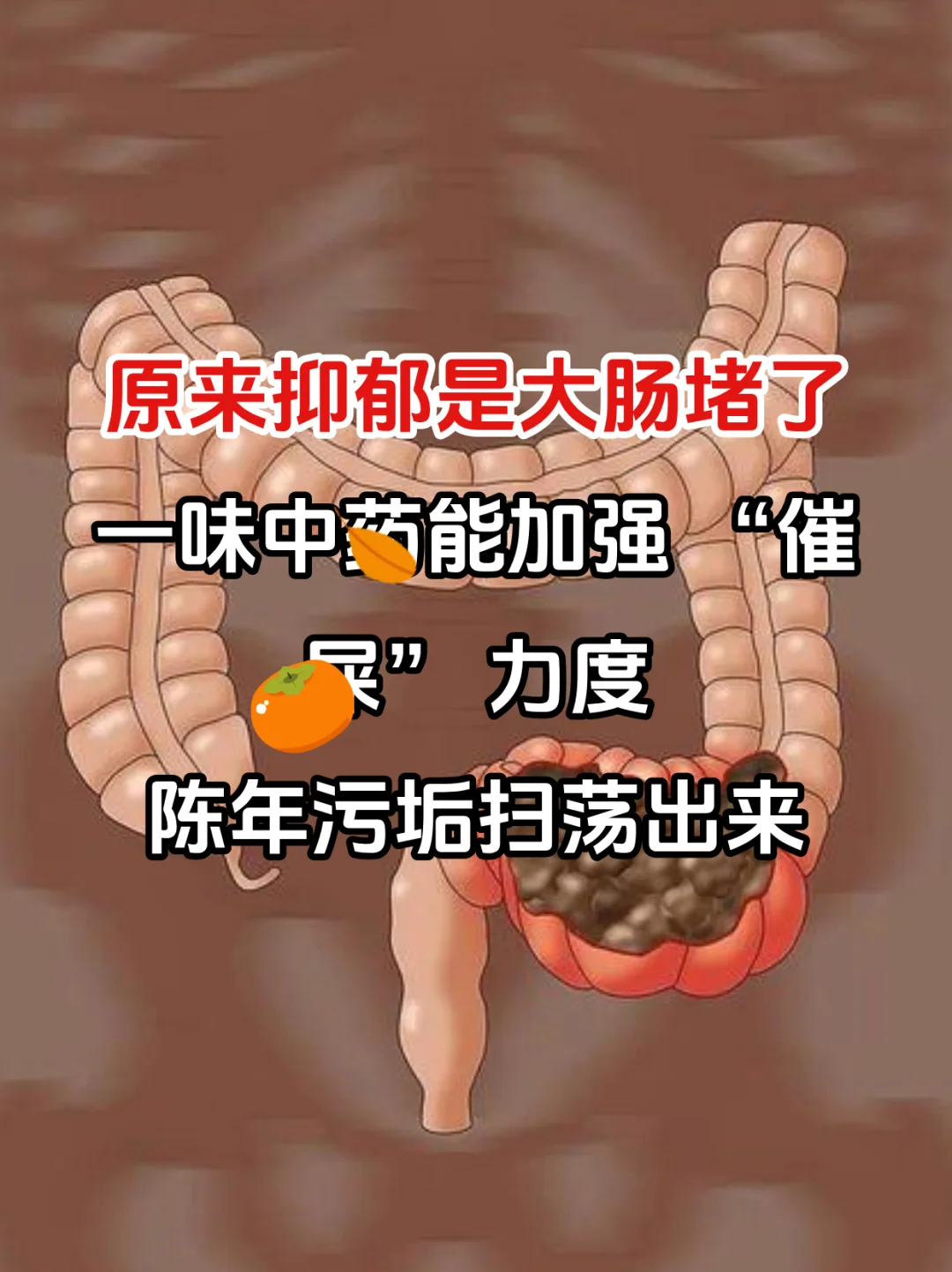 中医：原来抑郁，是大肠堵了