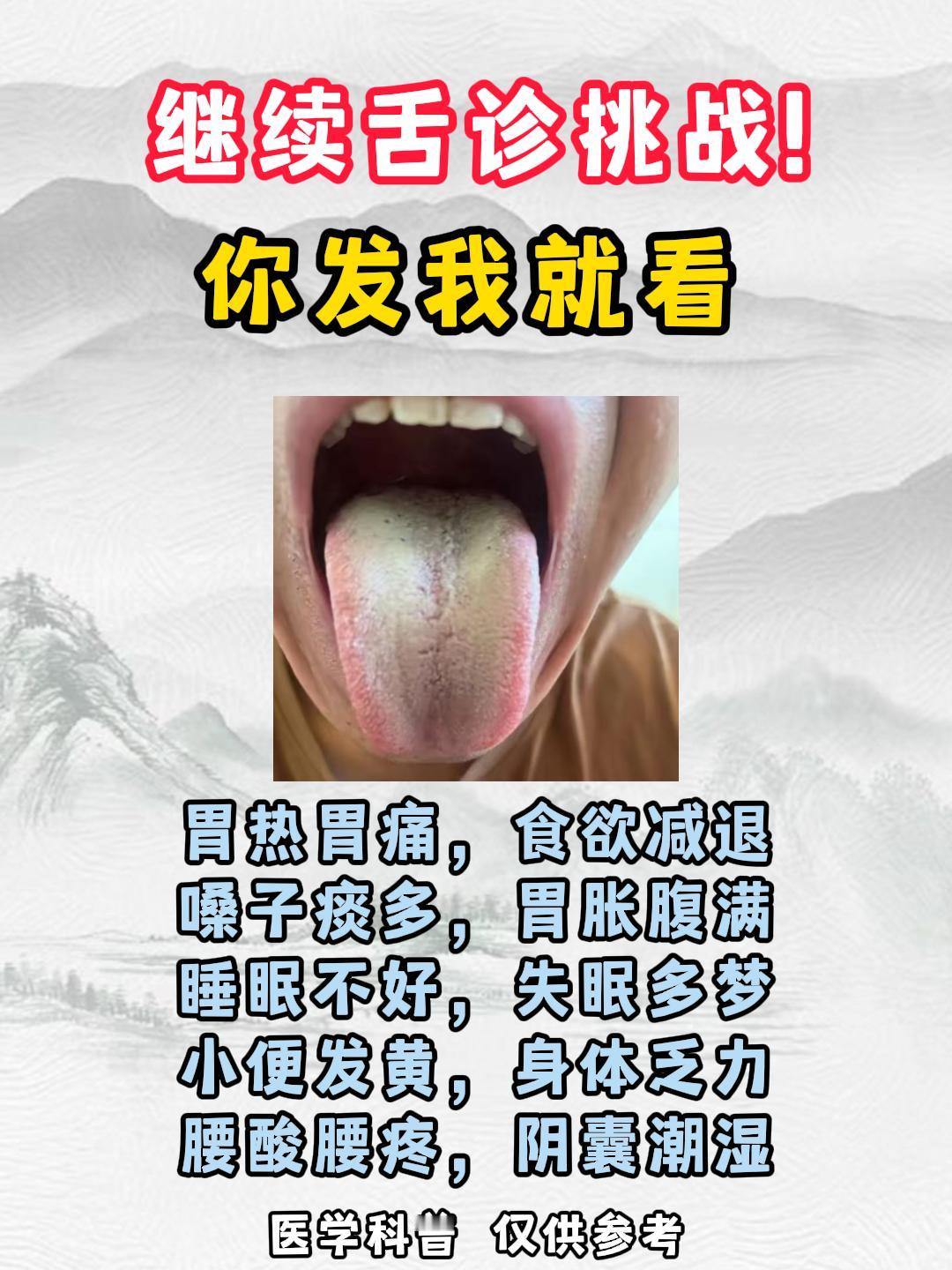 #舌象##舌诊##涨知识##健康##科普#