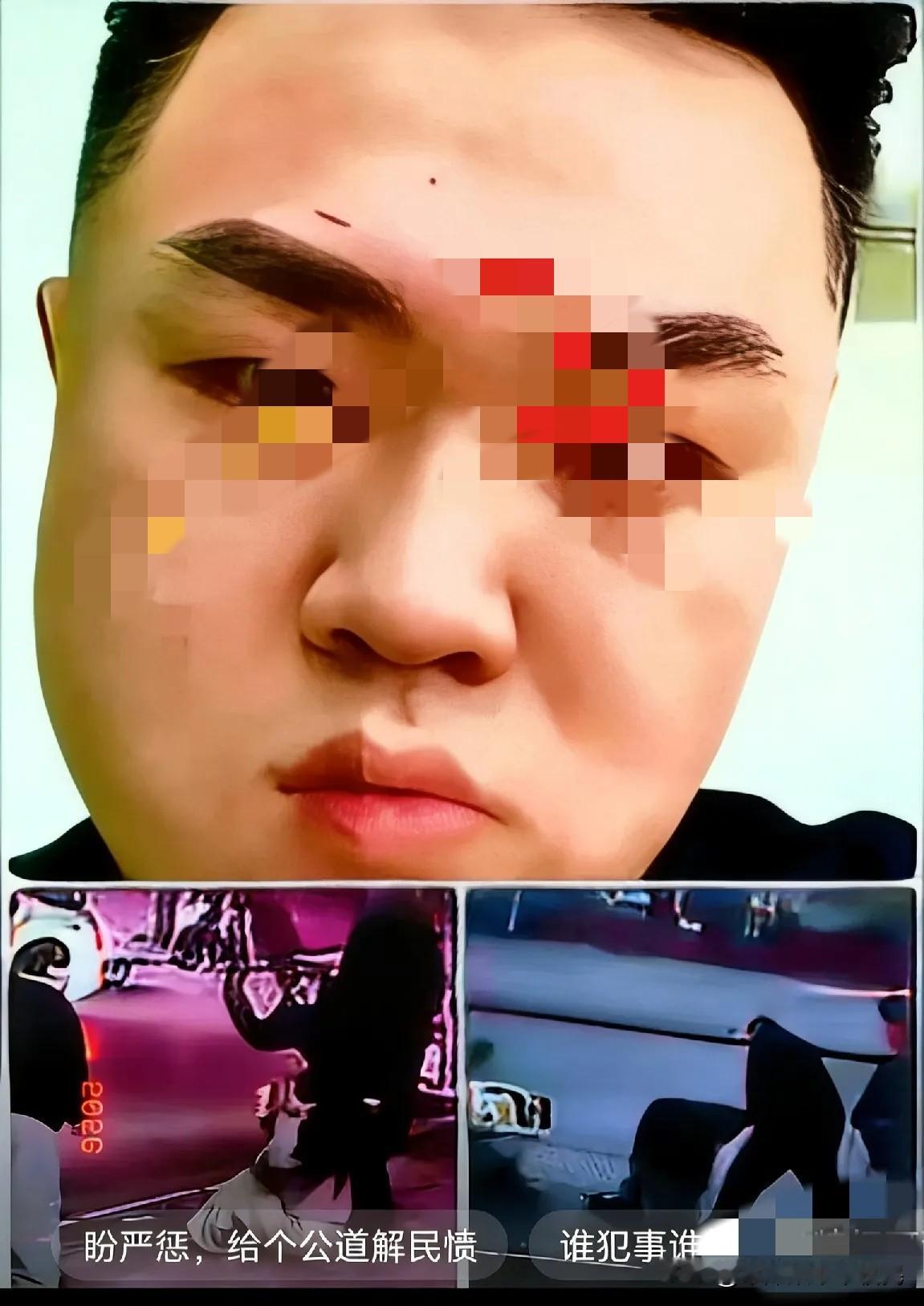 这俩货现在知道慌了！晚了！

当初动手往死里打，下手狠辣毫无顾忌，现在事情闹大全