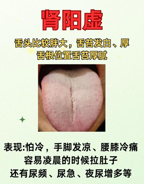 中医舌诊：3 种肾气亏虚证型的辨证要点