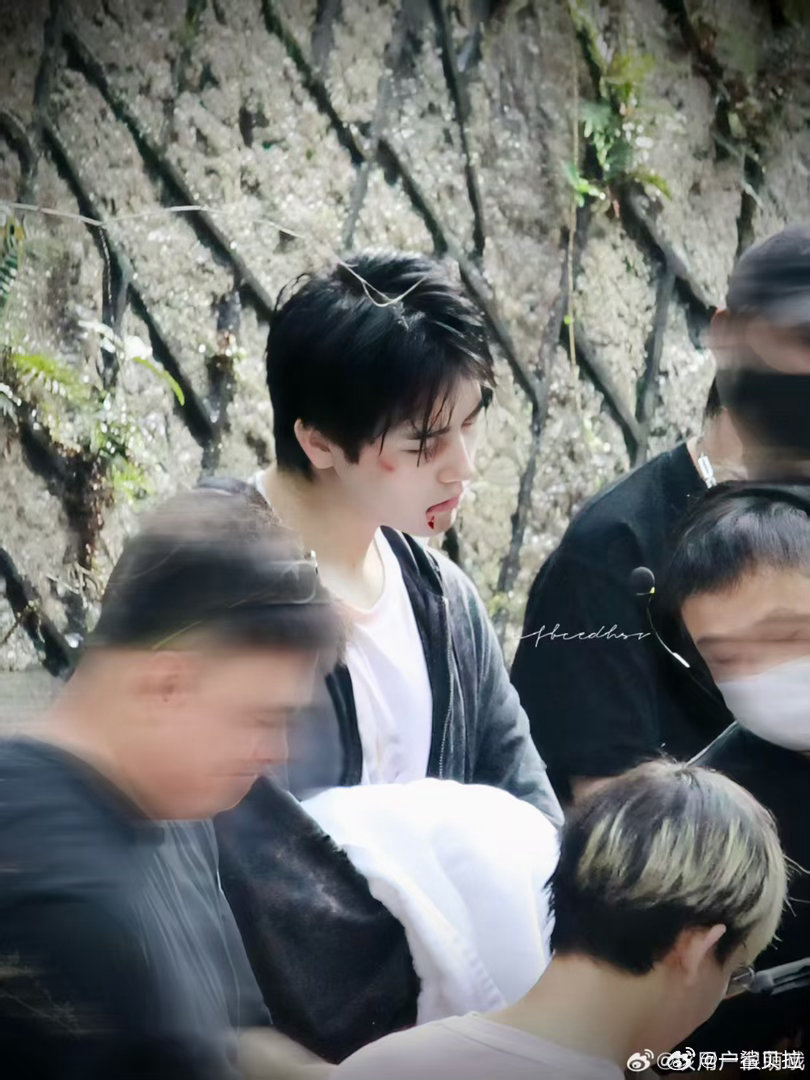 陈飞宇殴打妆不像化的 陈飞宇这妆造真的绝了，淤青和伤口的质感太真实，完全看不出化