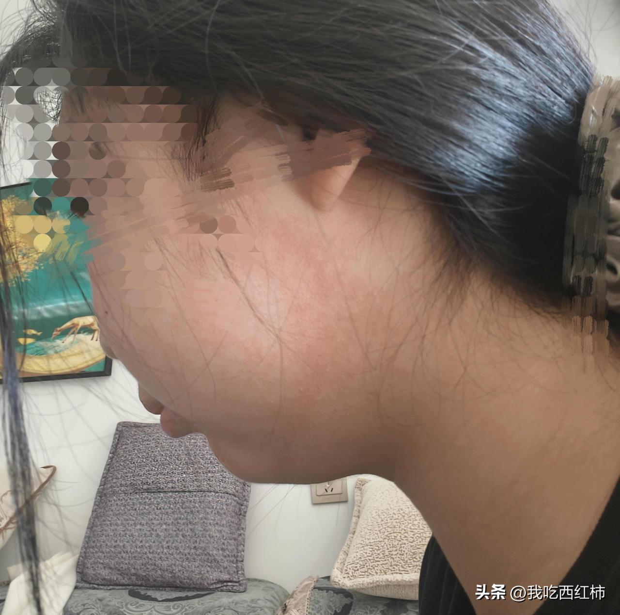 我是一名学生，从小学起就严重嗜睡，高中时甚至达到“站着都能睡着”的危险程度，并睡