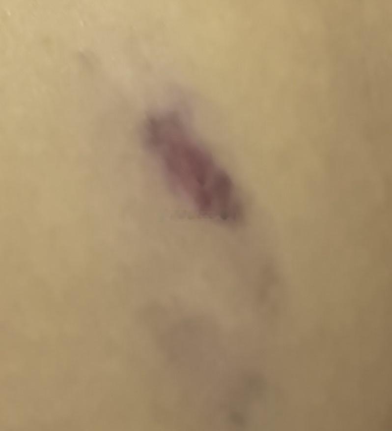 今天嗑到单元门上了
