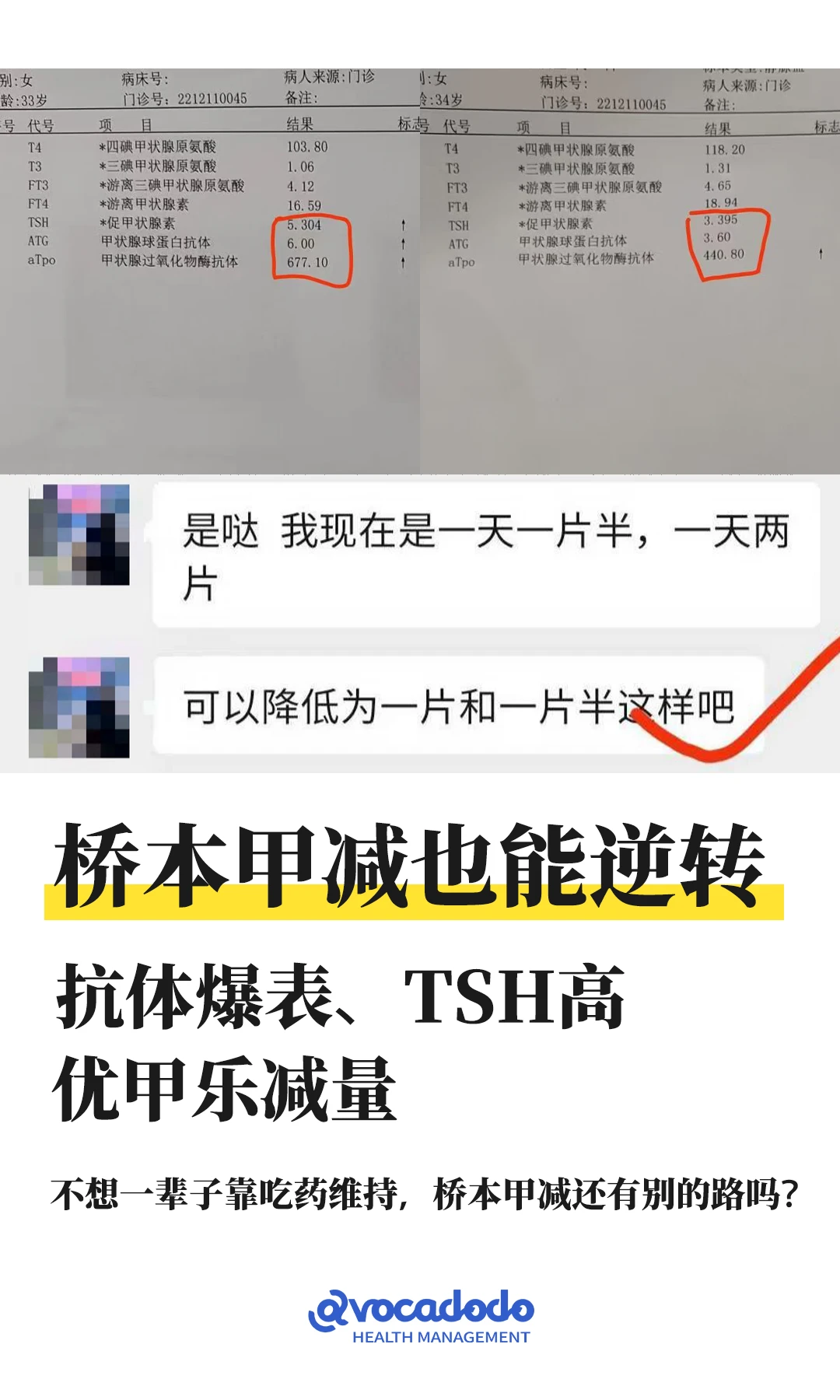 桥本甲减经验贴：抗体+TSH双降，优甲乐减量