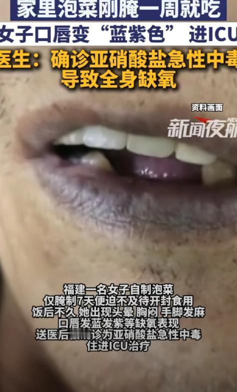 “悲剧还是发生了！”近日，福建，一女子食用腌制一周的泡菜后。没想到，亚硝酸盐急性