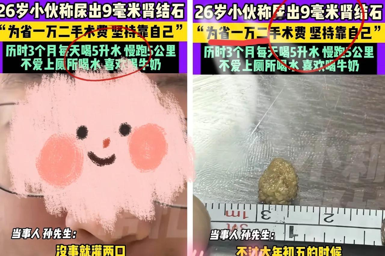 见过狠人，没见过这么狠的！

山东26岁小伙，为省一万多手术费听医生建议三个月每